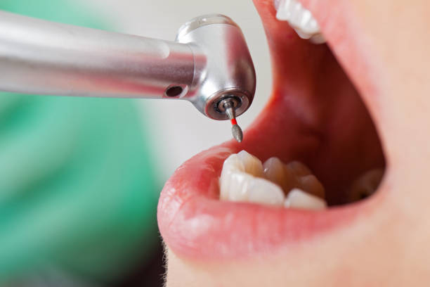 Best Pediatric Emergency Dentist in Lincoln, MO